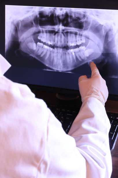 Best Emergency Tooth Extraction in West Laurel, MD