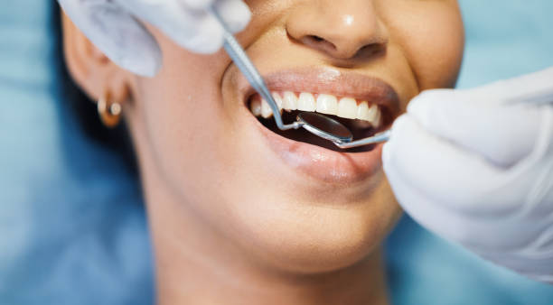 Best Emergency Treatment for Dental Infections or Abscesses in West Laurel, MD