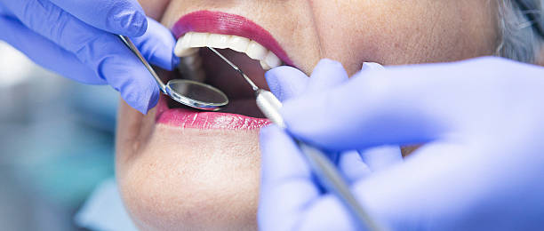 Fast & Reliable Emergency Dental Services in MD